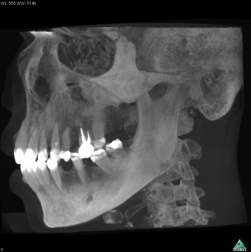 orthodontie adulte conebeam 3D