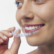 orthodontie, adulte, invisible, esthétique, gouttières, aligneurs, gouttieres, invisalign, orthocaps, clear aligner, essix