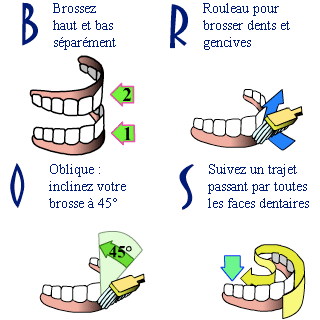brosse à dent, methode de brossage, orthodontie, ermont, eaubonne